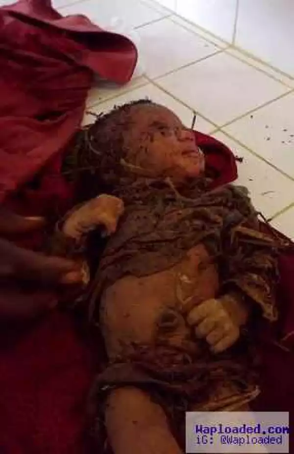 Photos: 2-day-old baby found alive in a 